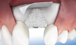 爆料种植牙套路视频大全,视频大全揭示行业潜规则